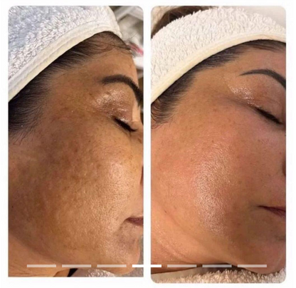 Crema Caviar - ÁCIDO HIALURÓNICO