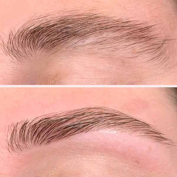 Depiladora Facial